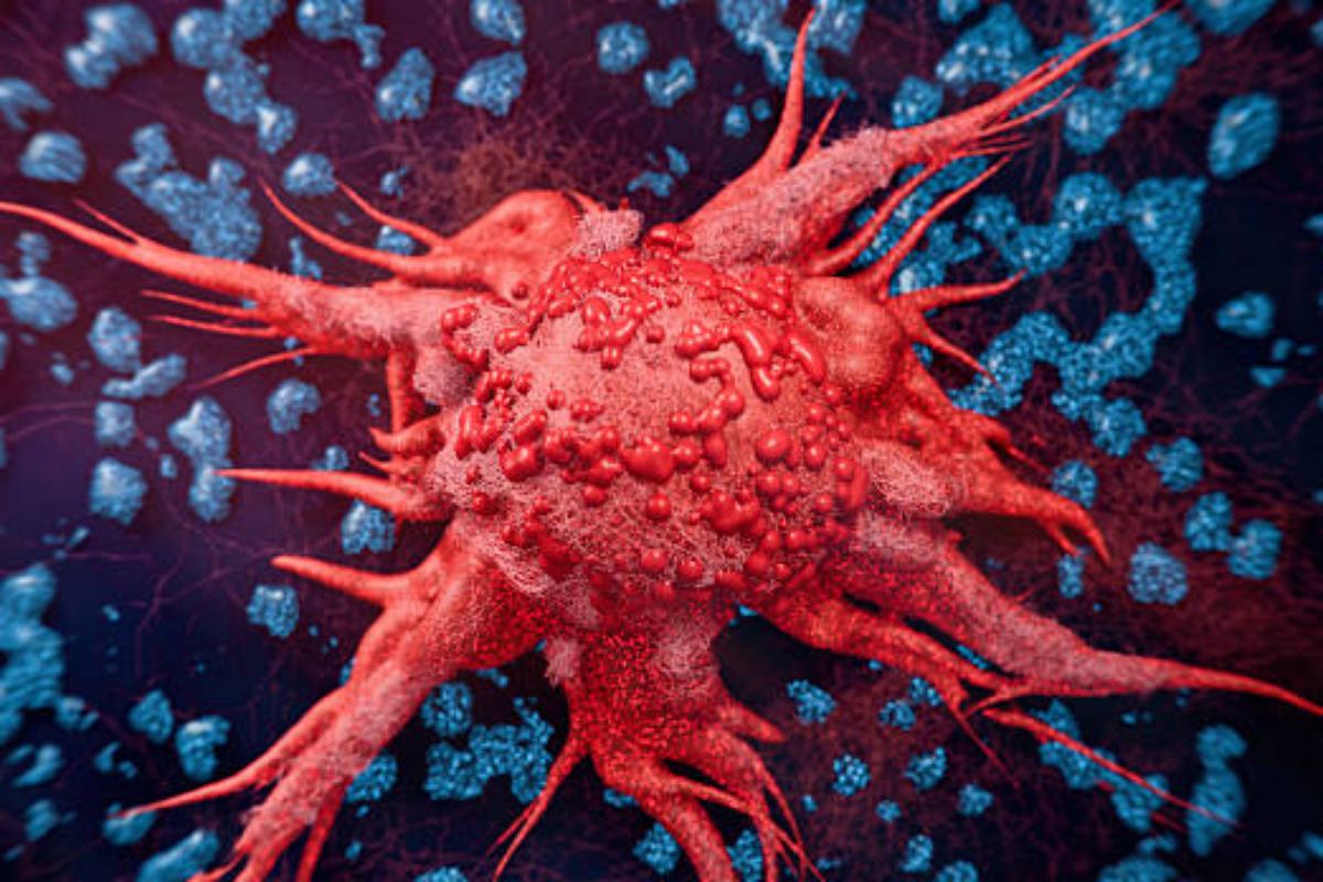 Tumori in Italia: cala la mortalità